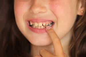 When should my child see an orthodontist?